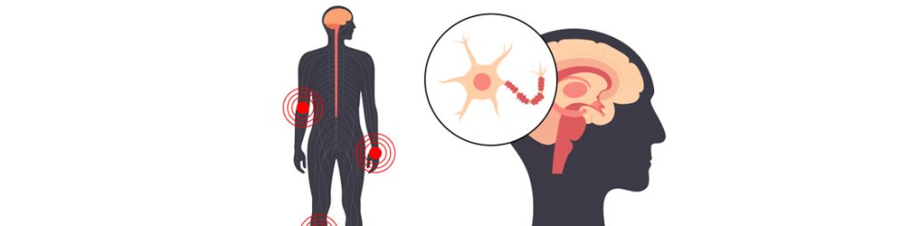 how long should i take pregabalin for nerve pain Vector